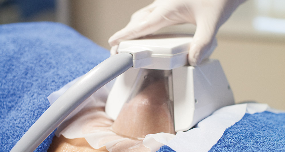 How Fat Freezing and HIFU Work Together? 2 Multiple Areas in One Session HIFU and Fat Freezing Livingston