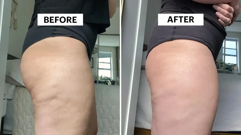 Do Toning Exercise Livingston Really Tackle Cellulite?