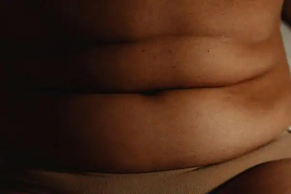 The Hidden Connection: How Stress Shapes Your Fitness and Body Composition 3 image of what stress can do on the stomach area and how Lipo 360 Livingston can help to change your body shape.